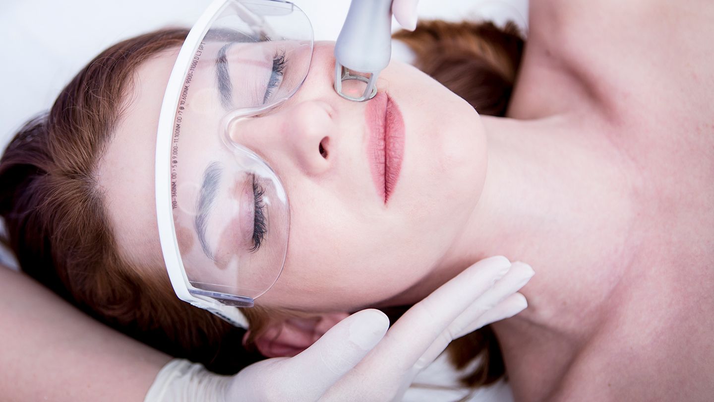 Laser Treatments for Skin Conditions