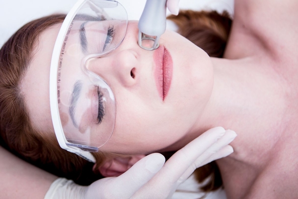 Laser Treatments for Skin Conditions