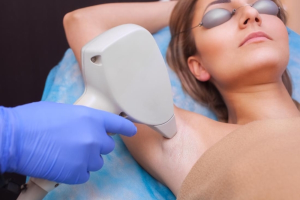 Trying Laser Hair Removal